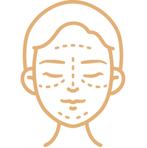 Blefaroplastia 